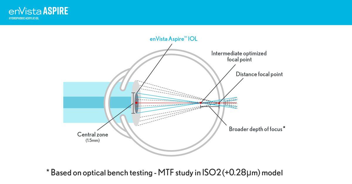 Introducing the Bausch and Lomb Aspire IOL: A New Standard in Vision Clarity