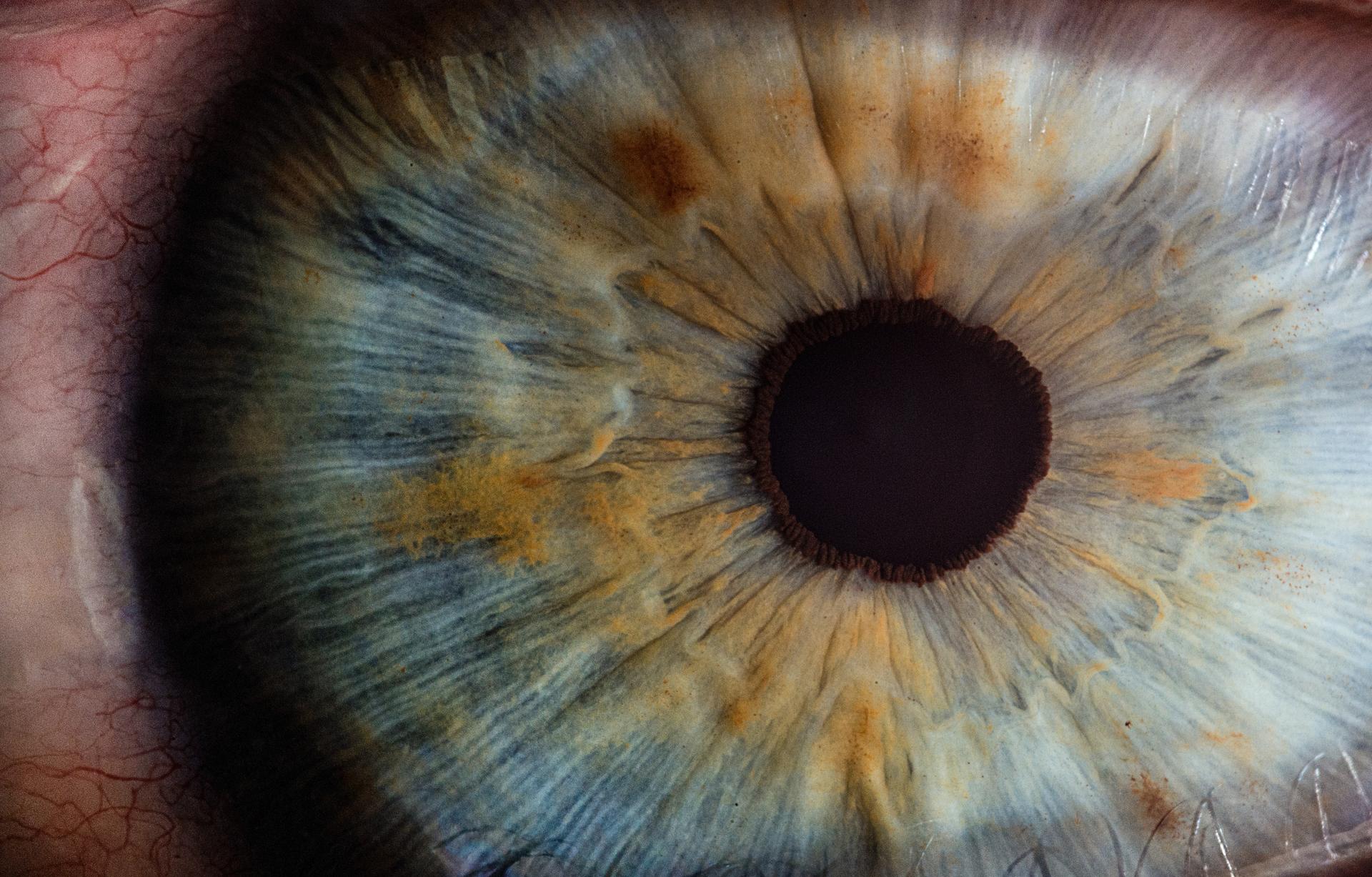 Prospects for the Iris – So What?