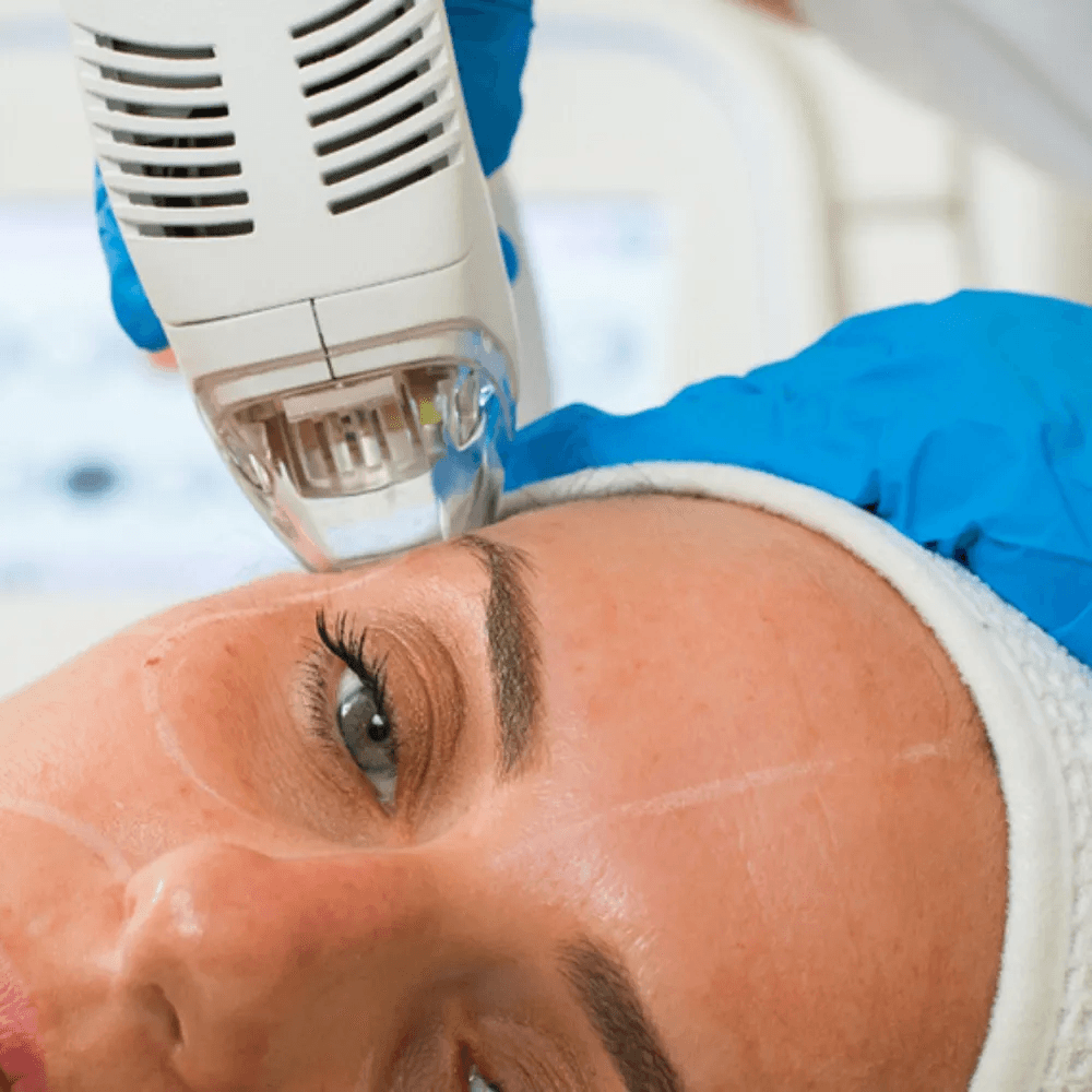 Supercharge Your Skin: The Novoxel Tixel Difference in Anti-Aging