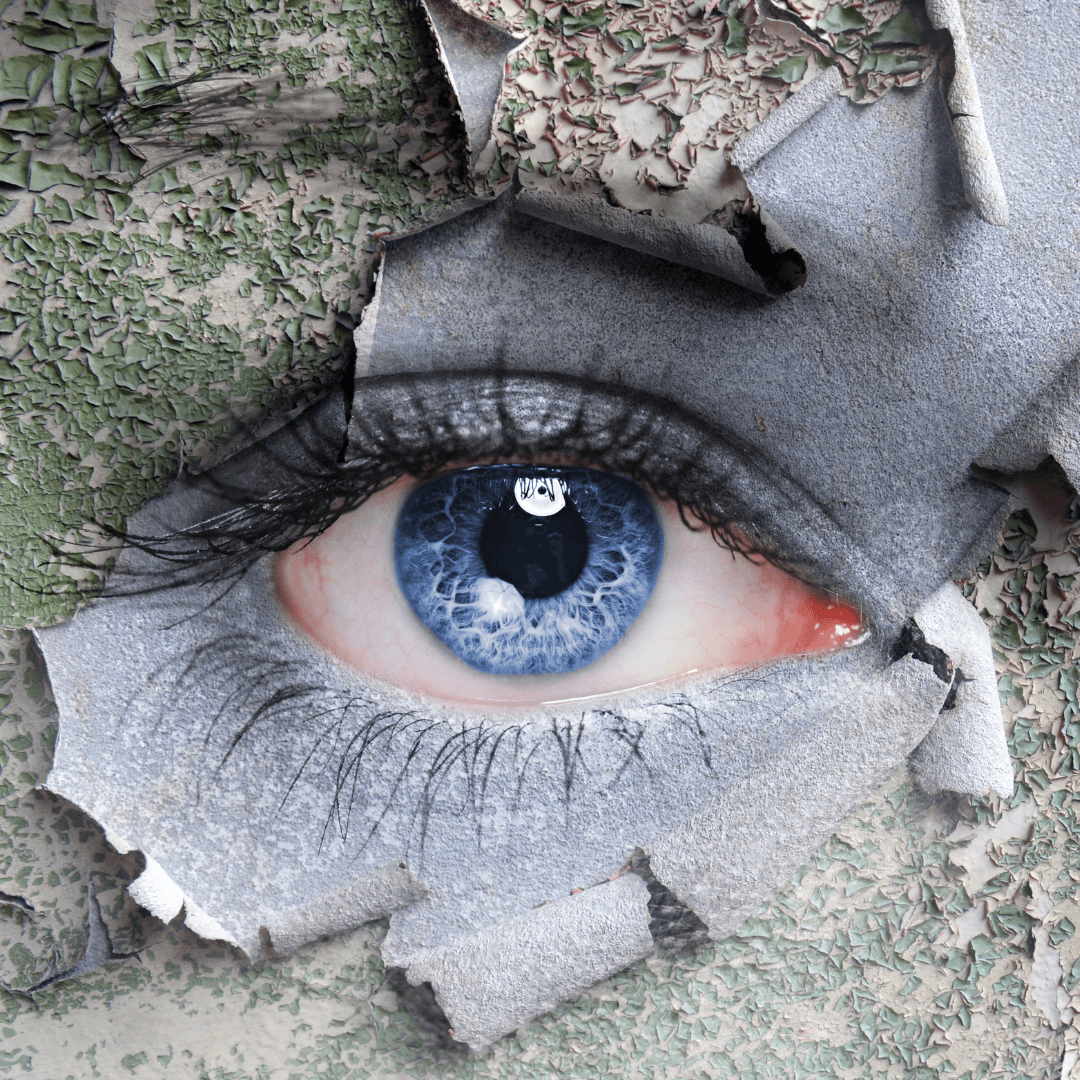 What You Need to Know About Dry Eye